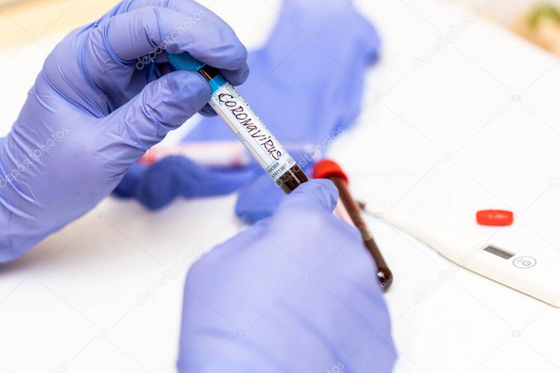 Еще 2 случая заражения коронавирусной инфекцией подтвердились в Оренбуржье
